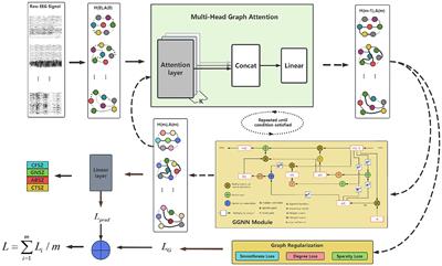 Classification of epileptic seizures in EEG data based on iterative gated graph convolution network